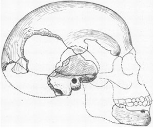 Skull